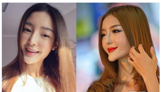 香港最老明星整容失败照片对比,整容失败的明星有哪些