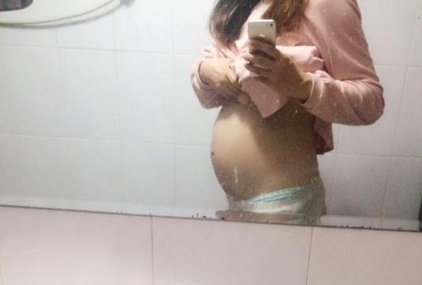 孕中晚期皮肤瘙痒不容小视！警惕妊娠肝内胆汁淤积