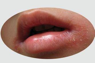 美白丸哪个牌子好六款美白丸推荐,安全有效的美白丸测评