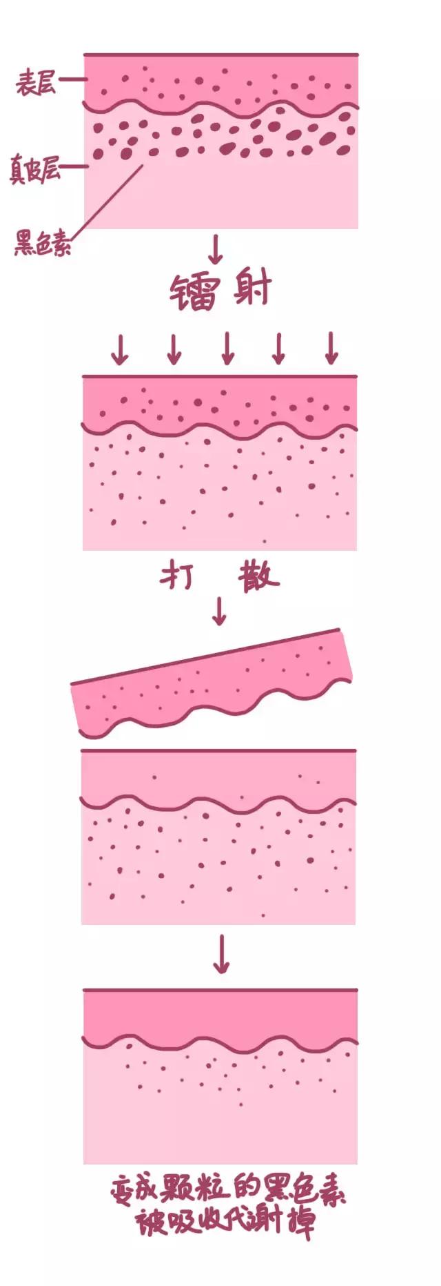 美肤医美项目,美肤美容项目