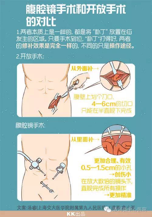 一个巨响的喷嚏过后，他被切下了小肠