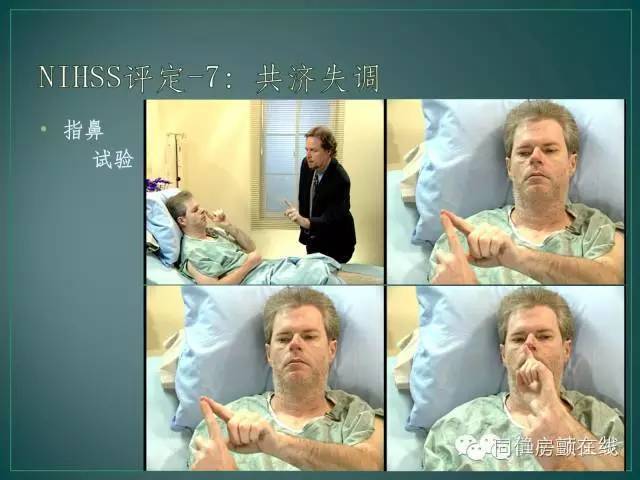 nihss评分2,nihss简单评分