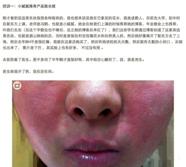 你们为年入2000万的网红们买单，她们却卖你一堆烂脸假货！