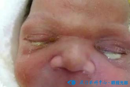 关于眼屎你还知道哪些知识,通过眼睛识人的口诀