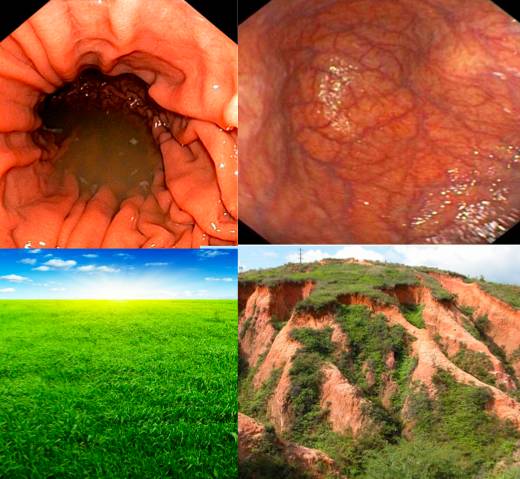 怎么在网上看胃镜活检报告,怎样通过关键词读懂胃镜活检报告