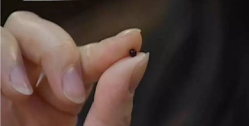 小孩子误吞珠子危害,小孩误吞塑料小珠子怎么办