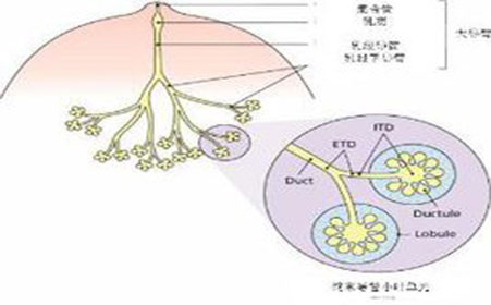 乳腺纤维瘤微创手术多少钱,乳腺纤维瘤多大适合做手术