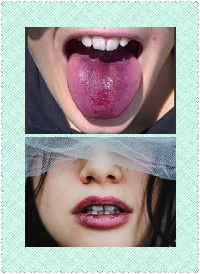 你喝完红酒牙齿是不是会被染成紫色？怎么办呢？