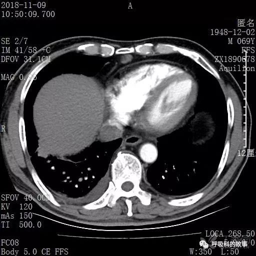 怎么应用统计学做调查,统计学方法可以解决的主要问题