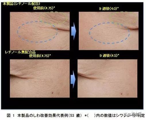 海蓝之谜三款眼霜哪款去皱最好,防过敏去皱紧致眼霜便宜又好用
