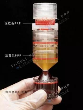 明星保养秘诀紧致提升淡化皱纹,医疗美容去皱纹抗衰老最有效方法