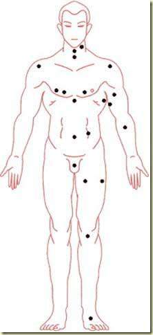 痣相看看你哪颗痣是好的,人10处有痣是富贵痣