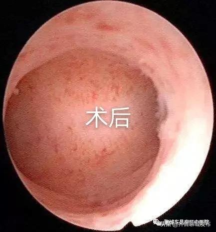 关爱女性健康为妇女健康保驾护航,呵护宫颈