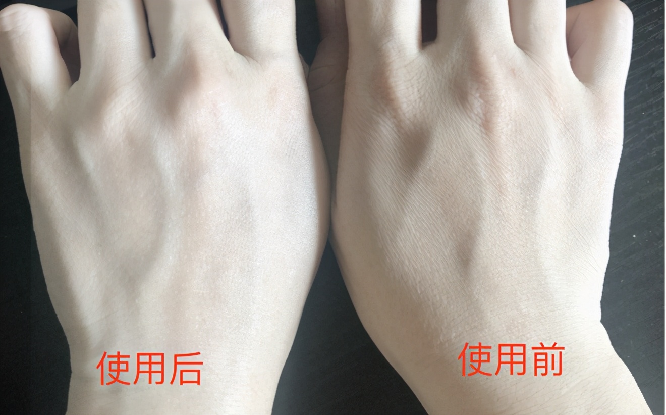 海豹油皮肤,海豹油外用美白效果怎么样