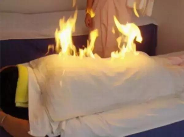 吓skr人！“火烤活人”可以治病？这种火疗很危险，小心玩火*焚自**！