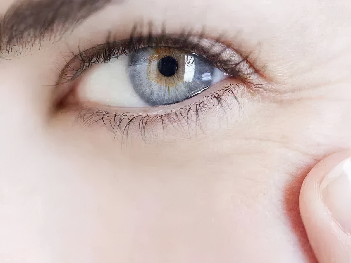 眼纹鱼尾纹怎么去除最有效的方法,眼睛鱼尾纹眼纹重怎么办