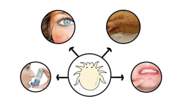 生活中常见的致命毒虫,澳洲常见的几种虫子