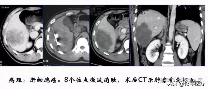 瑞金医院王忠敏,瑞金医院王忠敏简介