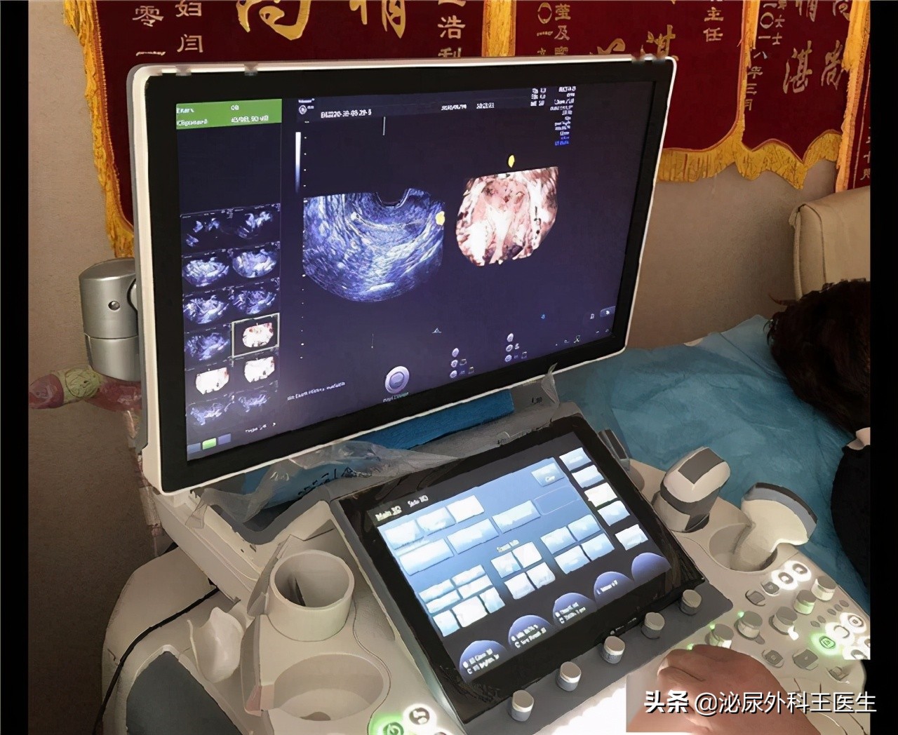 阴式b超是查什么的,阴式b超会检查出什么