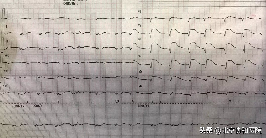 荆州95后护士救人,90后护士路边救人