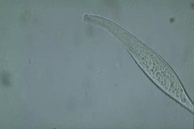 收藏!24种污水处理微生物菌相及指导意义,环保人必看(多图)