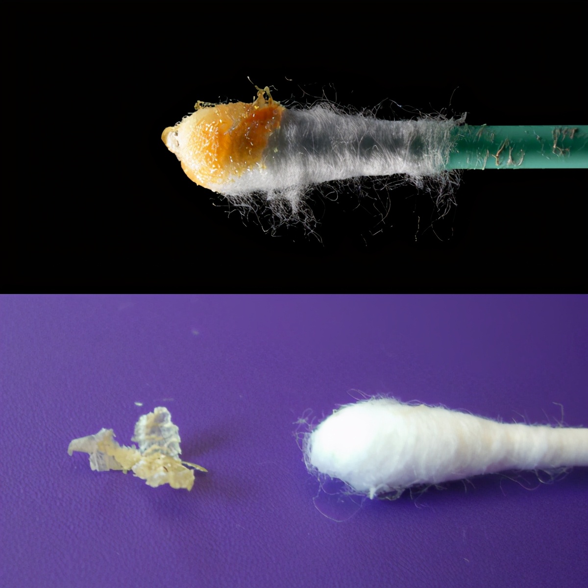 狐臭是怎么产生的?到底是疾病还是生理现象,该怎么根除?