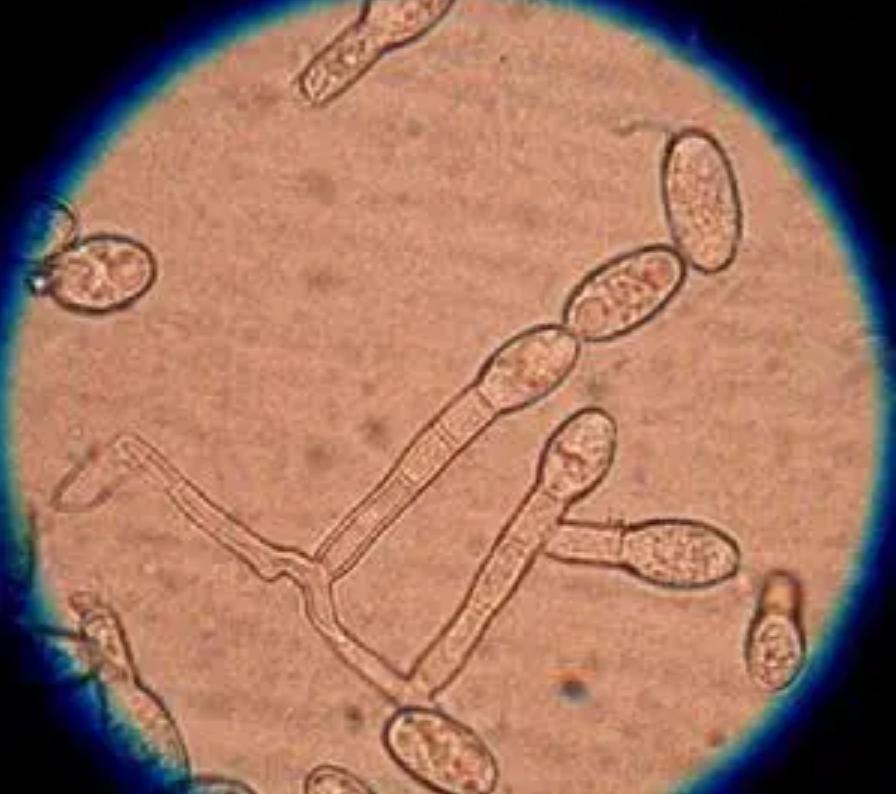 为何蛇类不怕雄黄粉了？蛇最怕什么？这就来解释原因