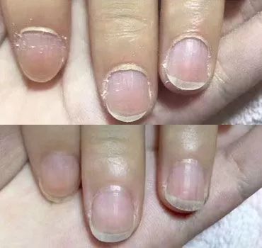 冬天脚跟干裂又起皮怎么办,冬天脚跟干裂起硬皮擦什么保湿好