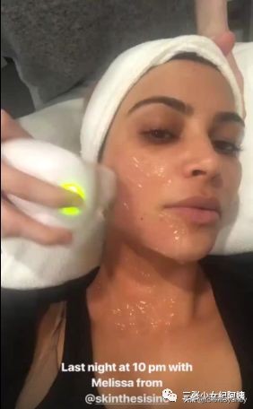 卡戴珊詹娜医美,卡戴珊太后医美