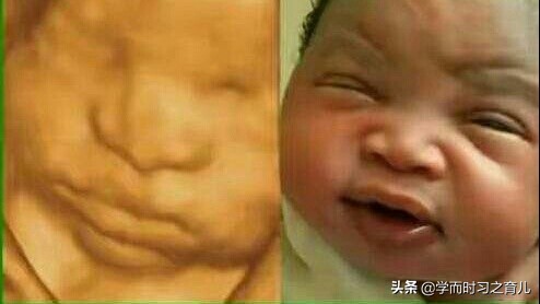孕妇四维图片上为什么会有阴影,宝宝四维照为什么鼻子嘴巴都很大
