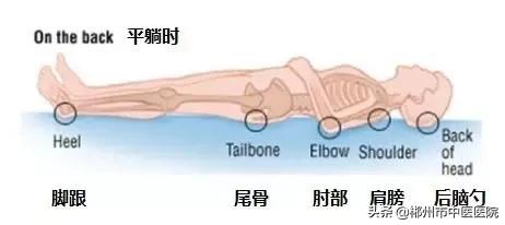 夏天卧床怎么预防褥疮,卧床病人预防褥疮的护理措施