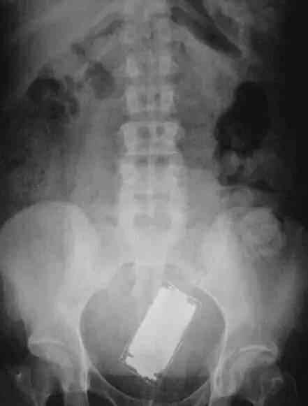 不作死就不会死看看你中了几条,不作死就不会死让人看的头皮发麻