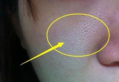 零毛孔让你的皮肤光滑细腻,教你一招搞定毛孔