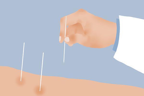 很容易闪到腰而且很疼是怎么回事,突然闪腰了怎么办