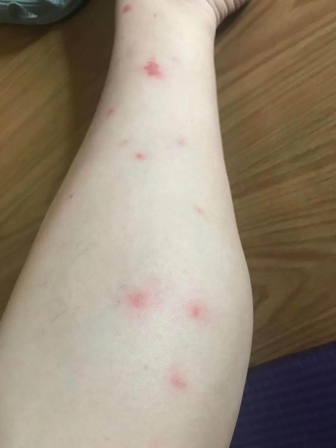 小咬蠓虫天敌,小咬蠓虫照片