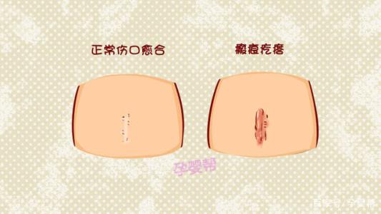 受伤了伤口愈合不了是什么病,伤口愈合后长了个肉球怎么回事