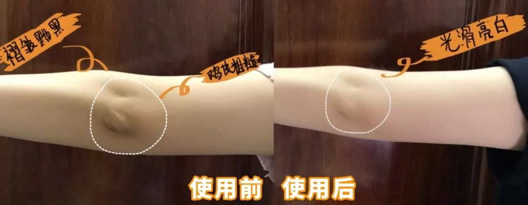 何穗美白淡斑霜,何穗竟比范冰冰还肤白