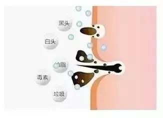 毛孔粗大收缩毛孔最有效的方法,毛孔粗大收缩毛孔最快有效的方法