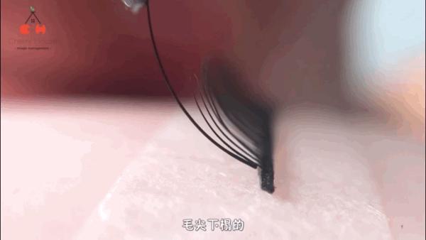 睫毛长扎眼睛该如何处理,睫毛长扎眼睛怎么办小妙招