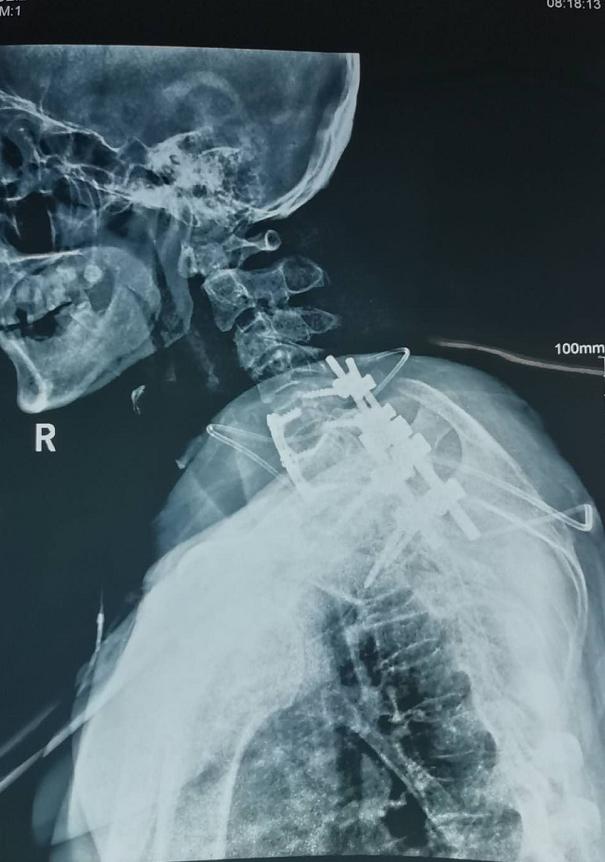 锦州市第二医院骨科,锦州市第二医院脊柱骨科门诊