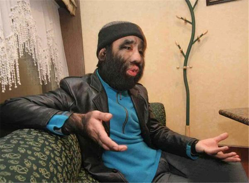 当年的毛孩现在做什么,最早的那个毛孩现在怎么样了