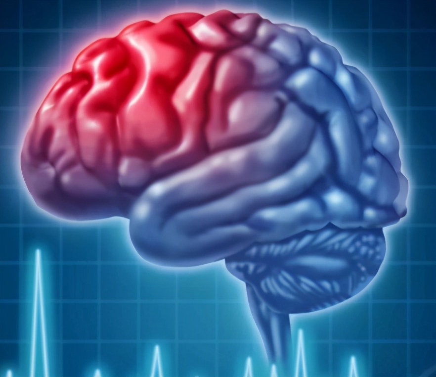 通心络胶囊能治疗脑梗塞吗,通心络胶囊对中风有预防作用吗