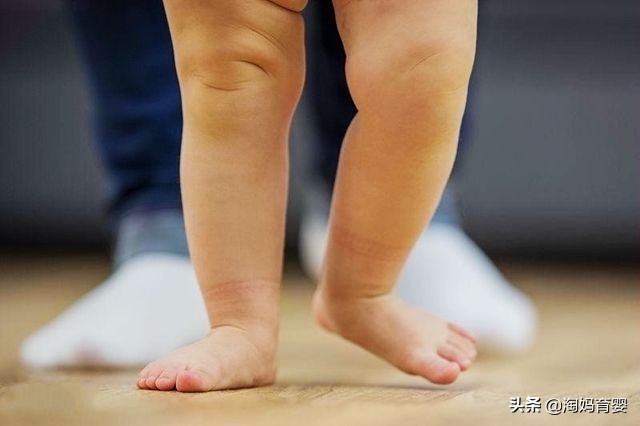 2岁小孩o型腿需要治疗吗,2岁以上的孩子有点o型腿正常吗