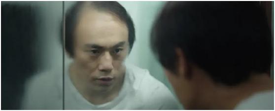 告别头秃脱发的中医疗法,隐秘的角落戴假发