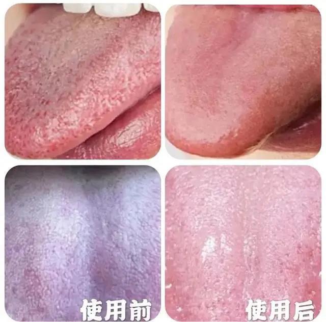 一张嘴臭牙齿就臭怎么办,一张嘴就口臭小妙招