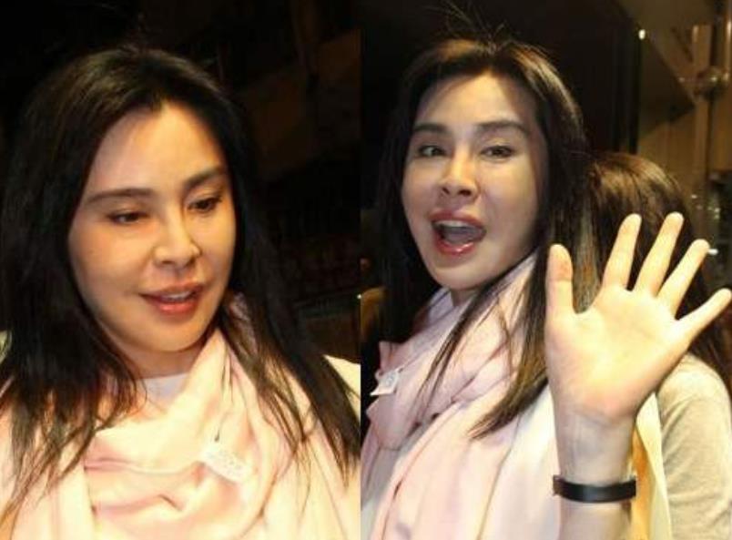 单眼皮、龅牙、厚嘴唇，这些缺陷美才是娱乐圈该有的百媚千红