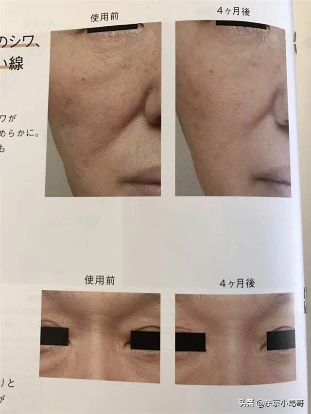 polasignsshot抗皱精华 (红腰子精华和pola抗皱精华)