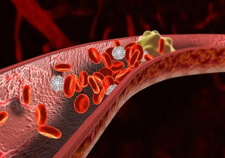 老年人打清血针好吗,清除血管垃圾输液用什么药