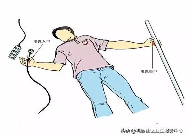 电击伤急救的方法和步骤,电击伤的急救与预防