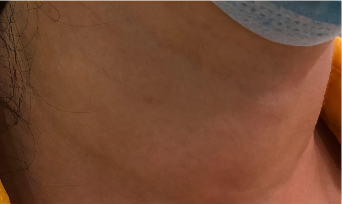 出汗很多手抖心慌看什么科,出汗手抖看什么科